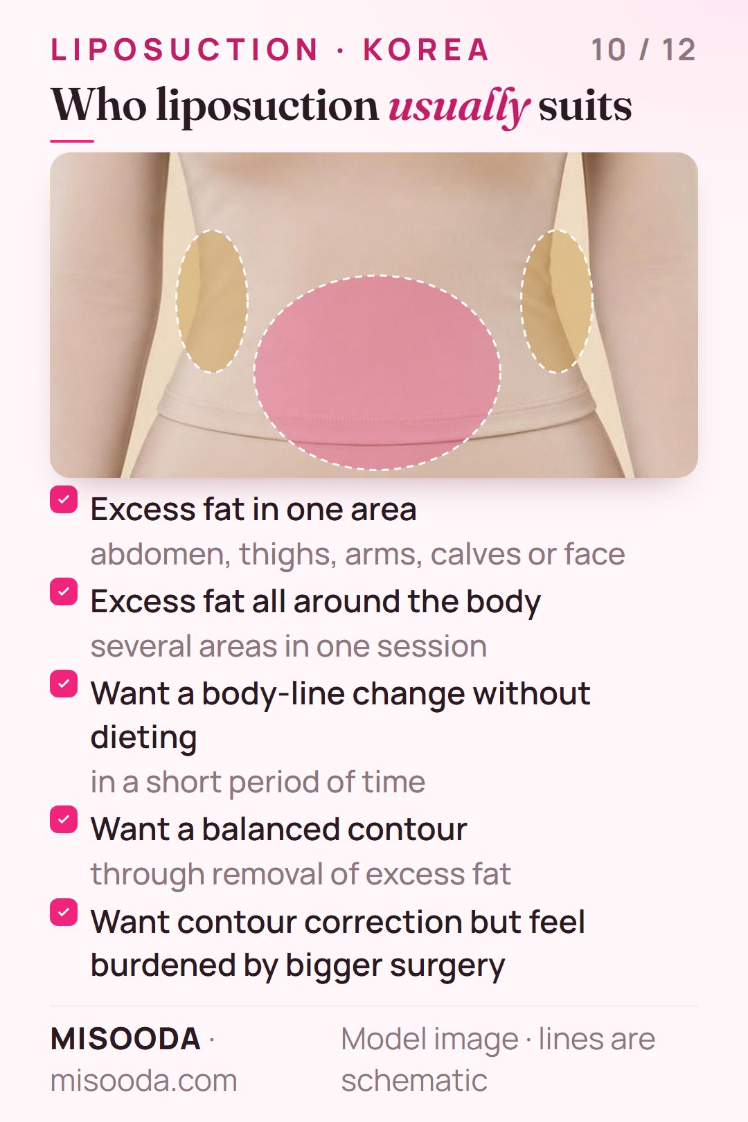 Liposuction candidates: excess fat in one area such as abdomen, thighs or arms, fat all over the body, or a body-line change without dieting