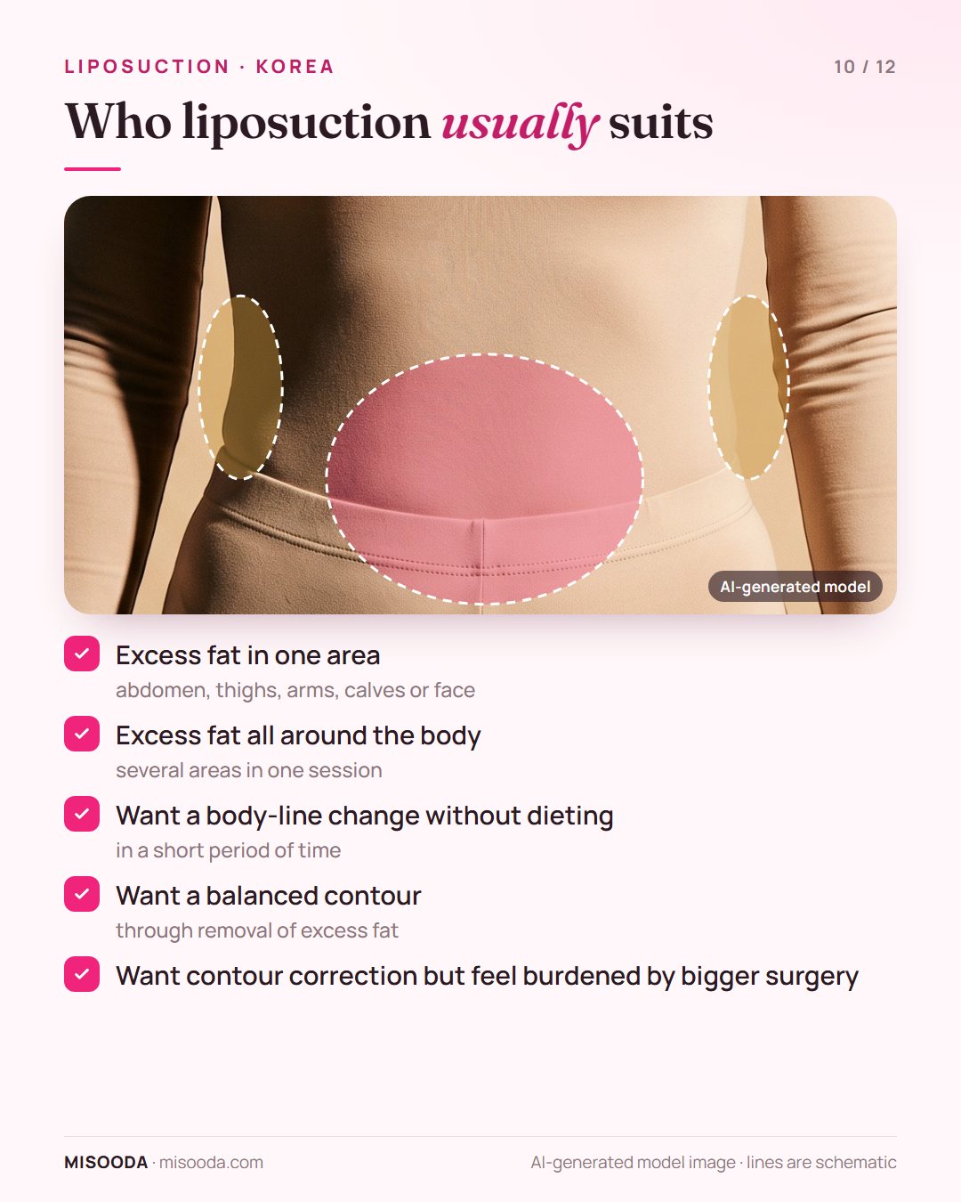 Liposuction candidates: excess fat in one area such as abdomen, thighs or arms, fat all over the body, or a body-line change without dieting