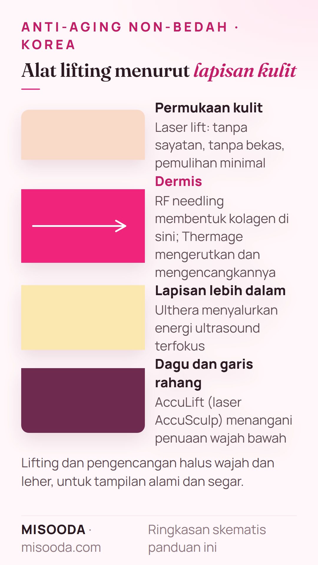 Alat laser lift non-bedah menurut lapisan kulit: RF needling dan Thermage bekerja di dermis, Ulthera di lapisan lebih dalam, AccuLift di bawah dagu dan rahang