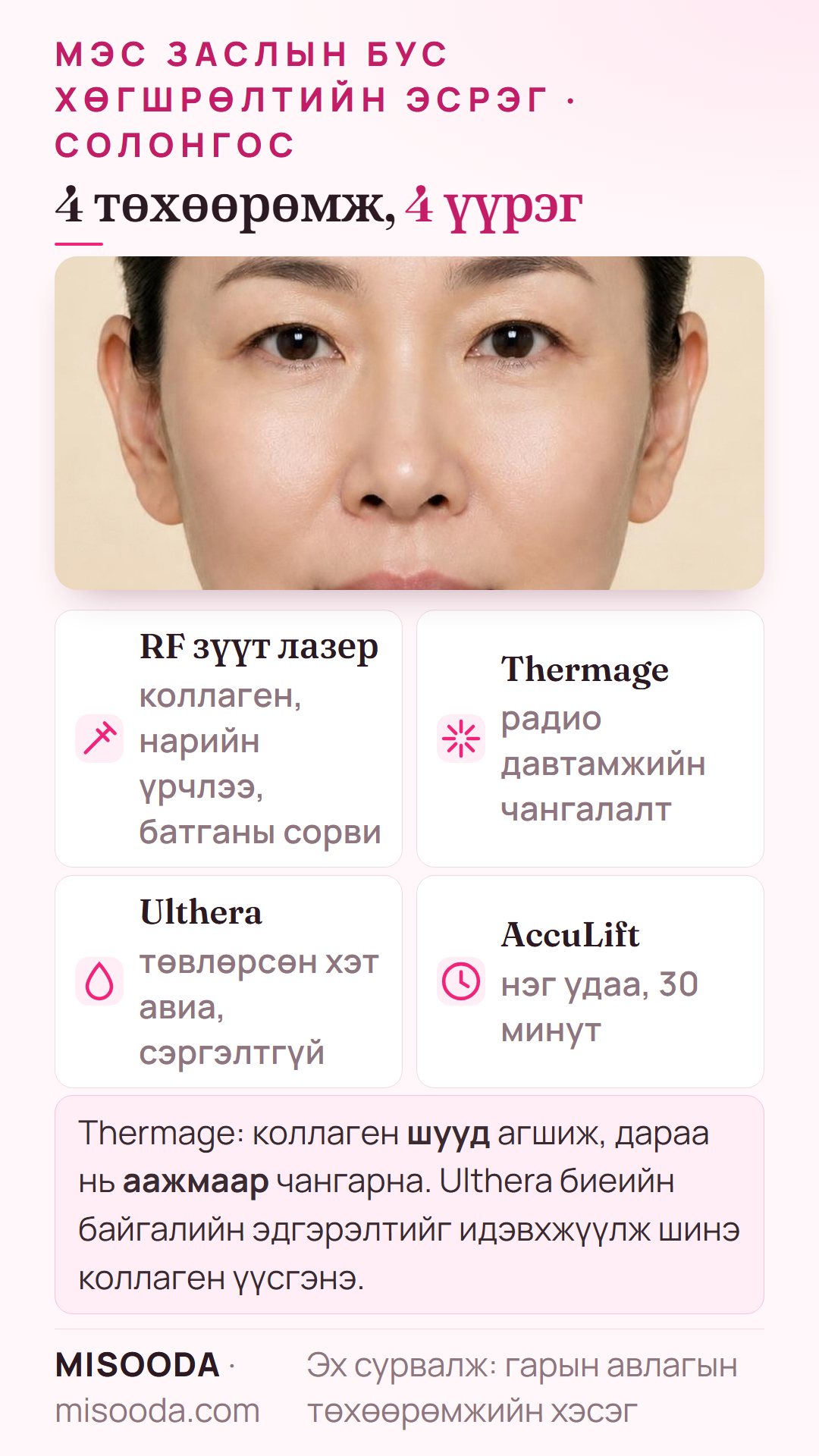 RF зүүт лазер, Thermage, Ulthera, AccuLift: коллаген ба батганы сорви, радио давтамжийн чангалалт, төвлөрсөн хэт авиа, нүүрний доод хэсгийн нэг удаагийн 30 минутын лазер