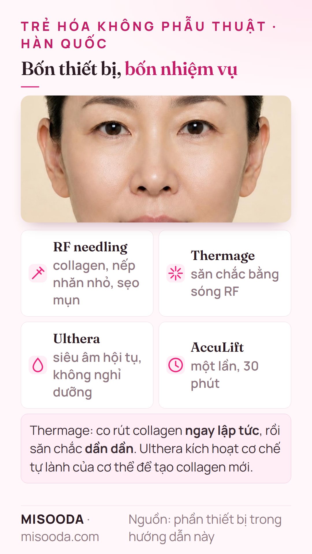 RF needling vs Thermage vs Ulthera vs AccuLift: collagen và sẹo mụn, săn chắc bằng sóng RF, siêu âm hội tụ, laser mặt dưới một lần 30 phút