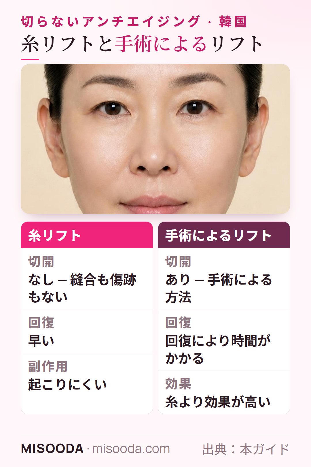 糸リフトと手術によるリフトの比較:縫合・傷跡なし、回復が早く副作用も少ないが、手術のフェイスリフトより効果は控えめ — 韓国 糸リフト