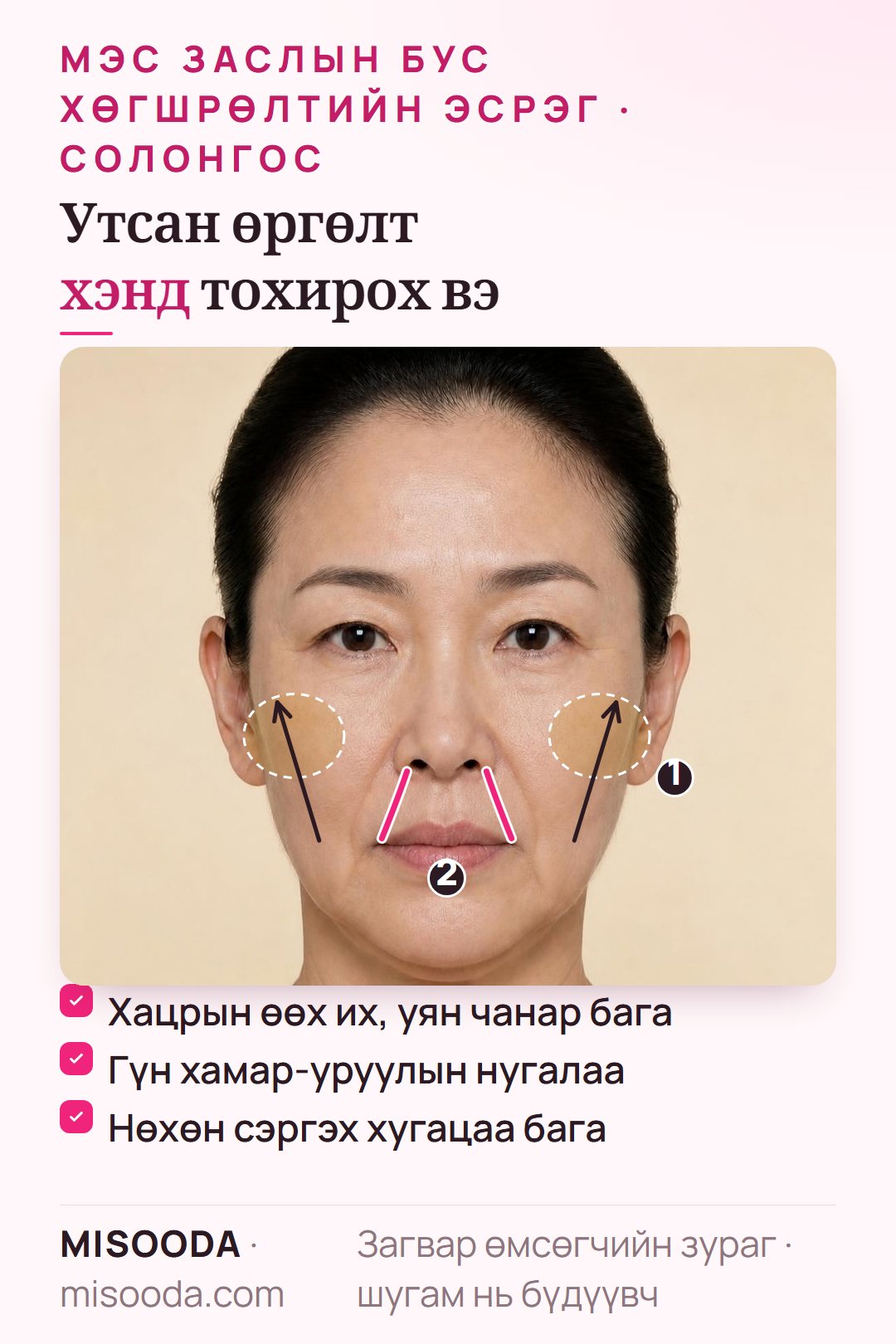 Утсан өргөлтөд тохирох хүмүүс: залуу насандаа хацрын өөх их, уян чанар бага, гүн хамар-уруулын нугалаа, унжсан хацар, мэс заслын сэргэлтэд цаг бага