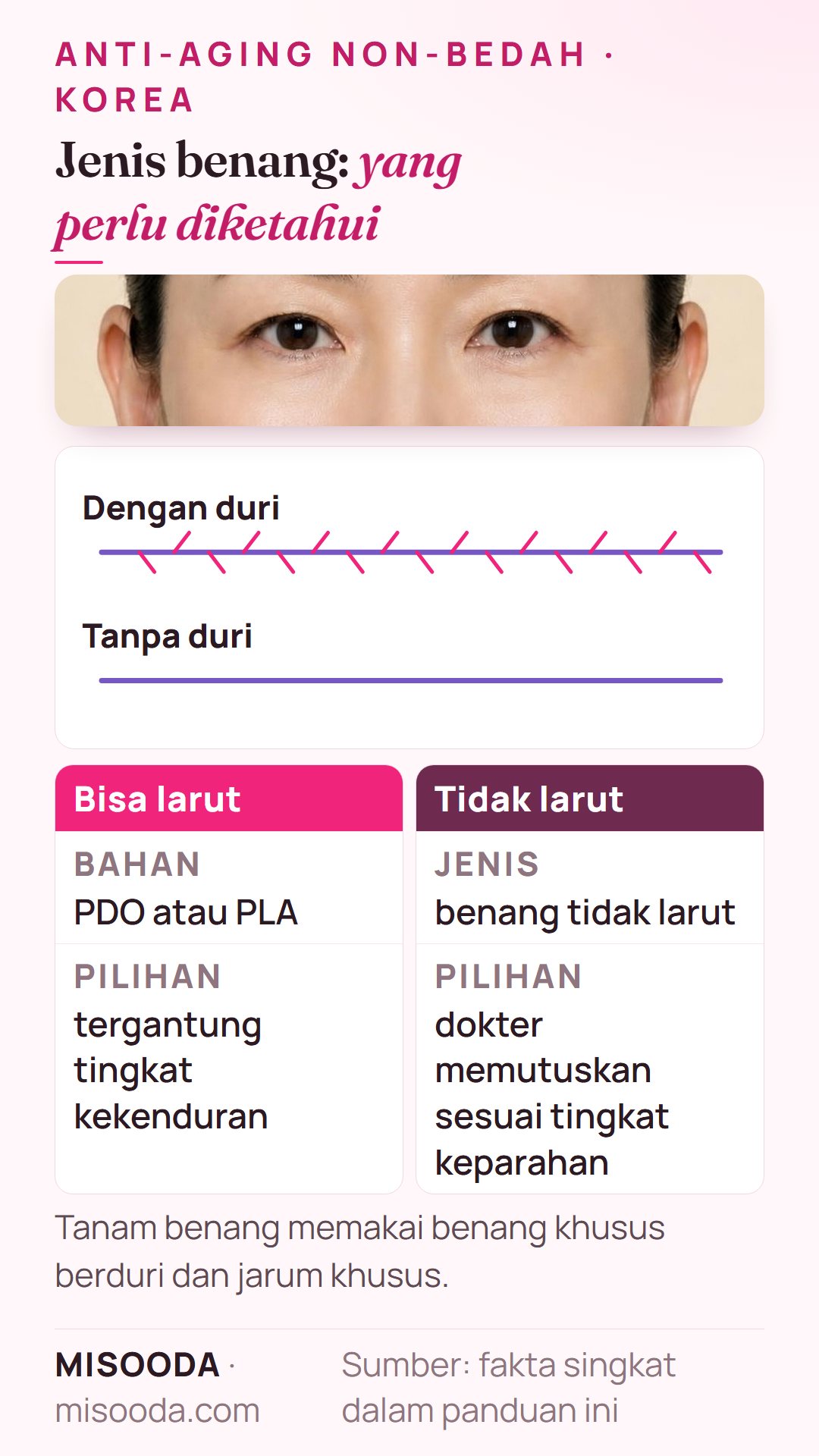Jenis benang anti-aging: PDO atau PLA yang larut vs benang tidak larut, serta benang dengan atau tanpa duri, dipilih sesuai tingkat kekenduran