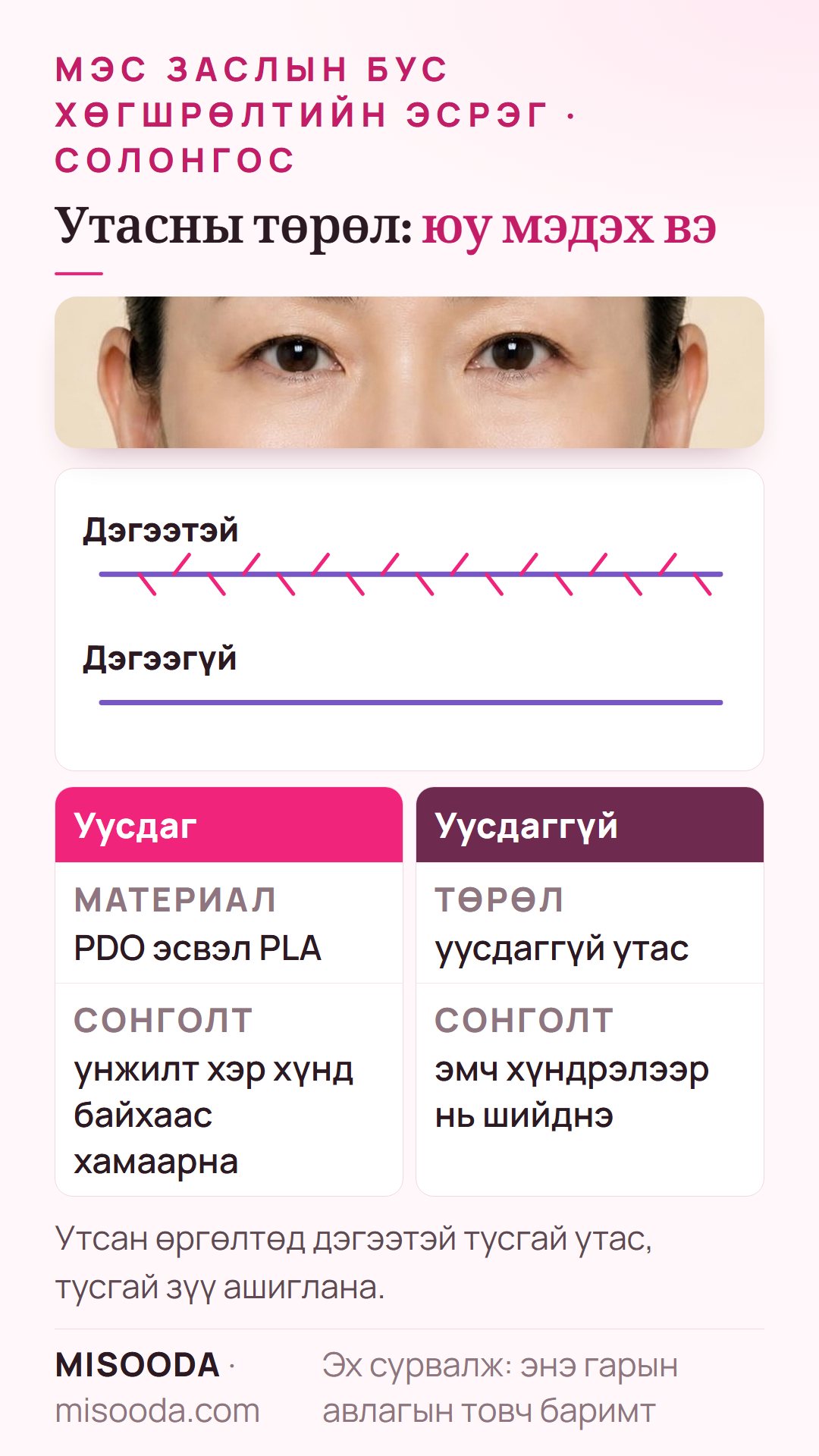 Хөгшрөлтийн эсрэг утасны төрөл: уусдаг PDO эсвэл PLA ба уусдаггүй утас, дэгээтэй эсвэл дэгээгүй утсыг унжилтын хүндрэлээр сонгоно
