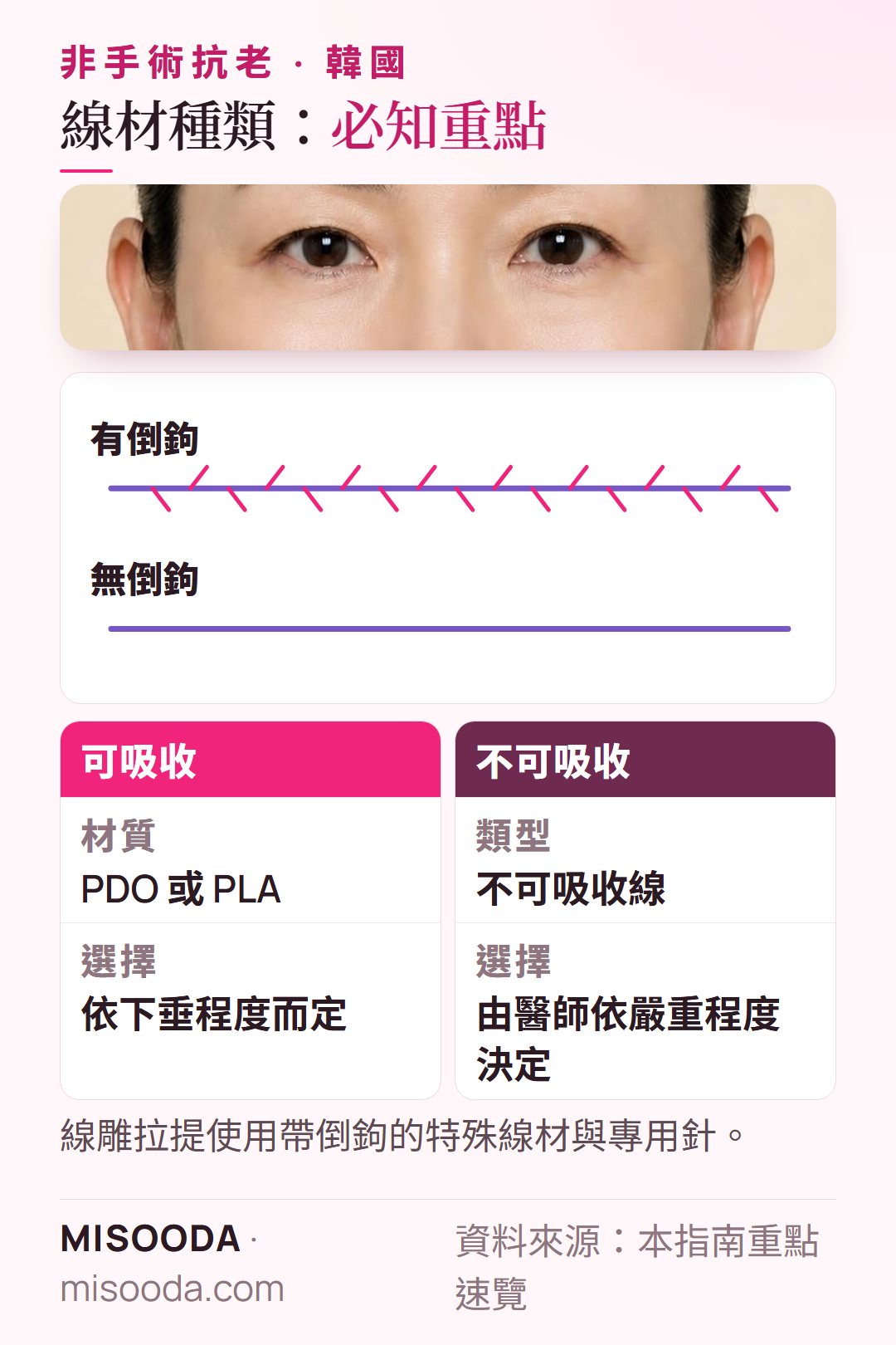 韓國 抗老線雕線材種類:可吸收 PDO 或 PLA vs 不可吸收線,有倒鉤或無倒鉤,依下垂程度選擇