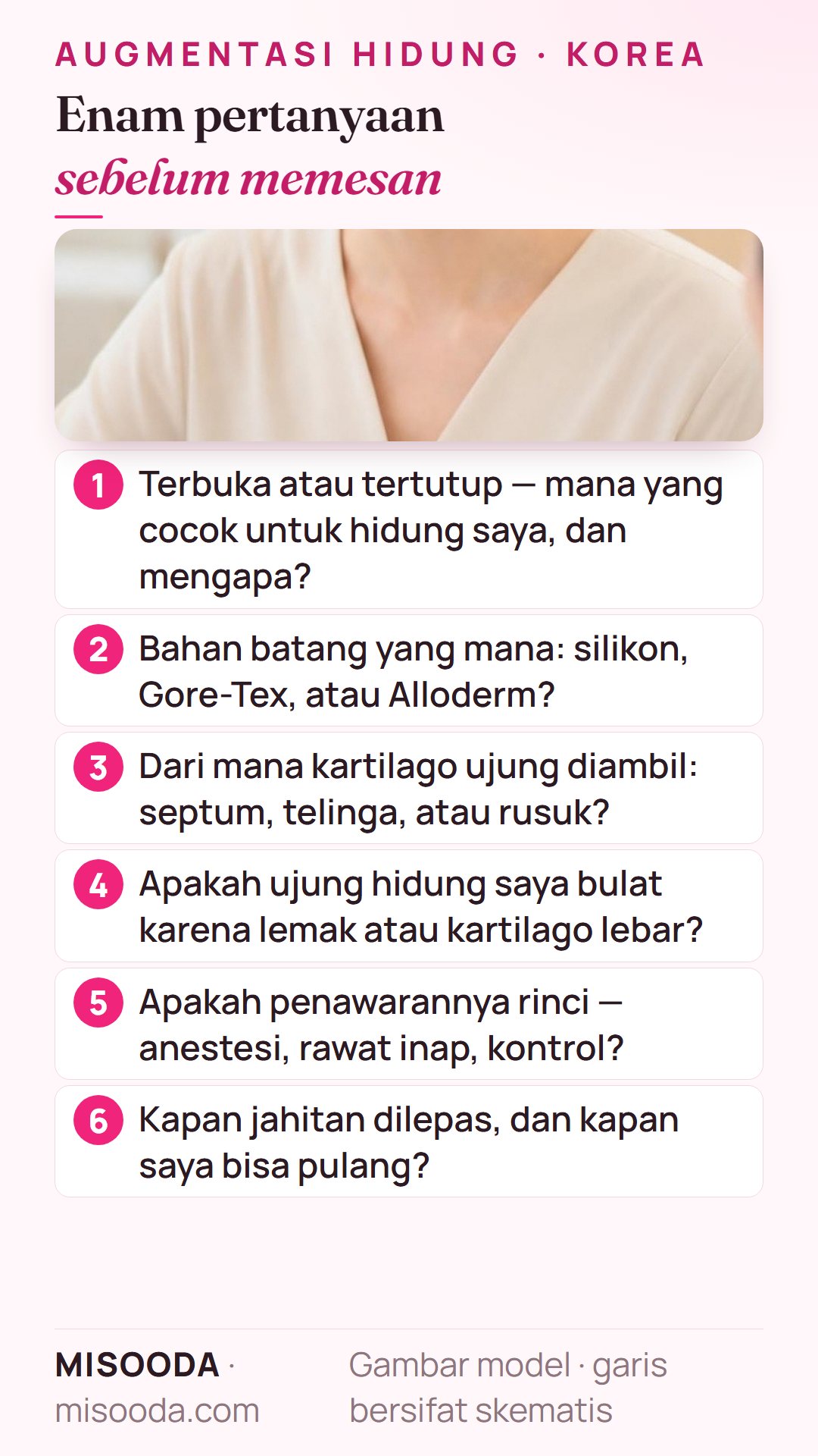 Enam pertanyaan sebelum memesan operasi hidung di Korea: terbuka atau tertutup, bahan batang, sumber kartilago ujung, penyebab ujung bulat, penawaran rinci, lepas jahitan