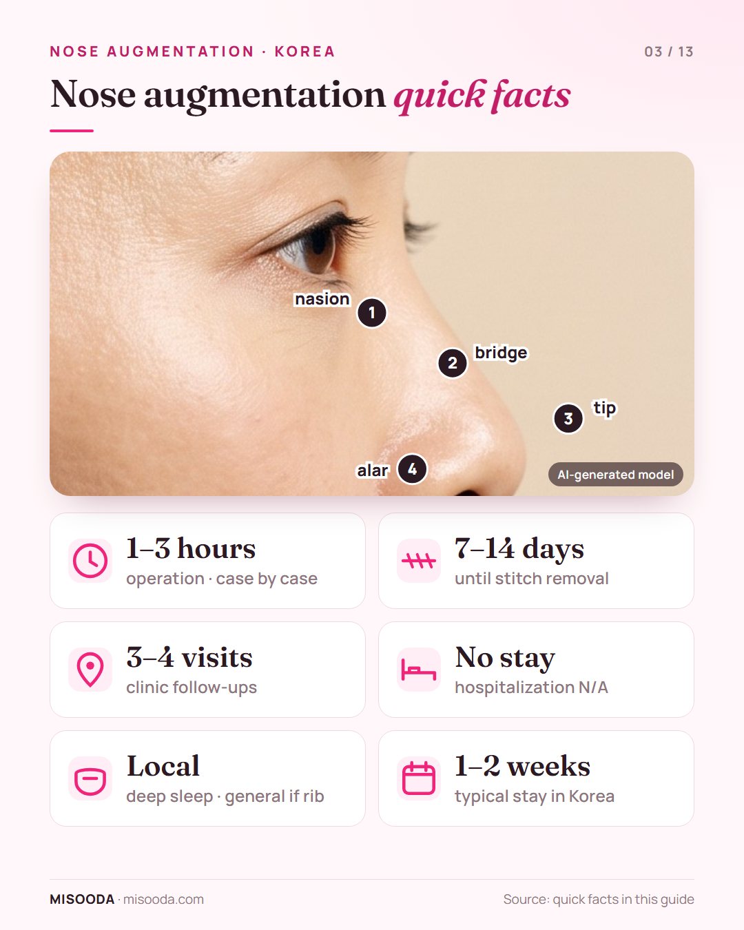 Nose augmentation quick facts: nasion, bridge, tip and alar surgery sites, 1–3 hours surgery, stitch removal after 7–14 days, 3–4 clinic visits, 1–2 week stay