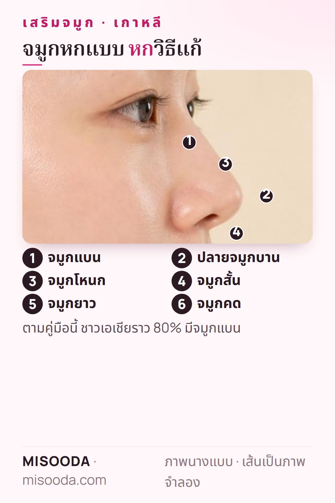 ลักษณะจมูกหกแบบสำหรับเสริมจมูก เกาหลี: จมูกแบน ปลายบาน โหนก สั้น ยาว และคด แต่ละแบบมีวิธีแก้ของตนเอง