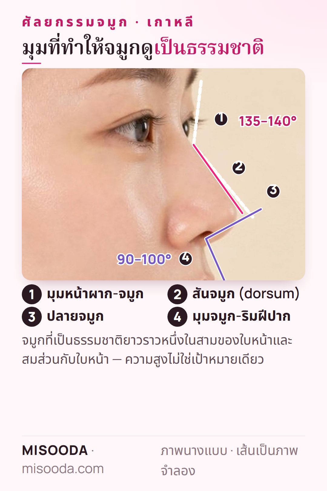 สัดส่วนจมูกในอุดมคติสำหรับศัลยกรรมจมูก เกาหลี: มุมหน้าผาก-จมูกประมาณ 135–140° มุมจมูก-ริมฝีปากประมาณ 90–100° สันและปลายจมูกในมุมด้านข้าง