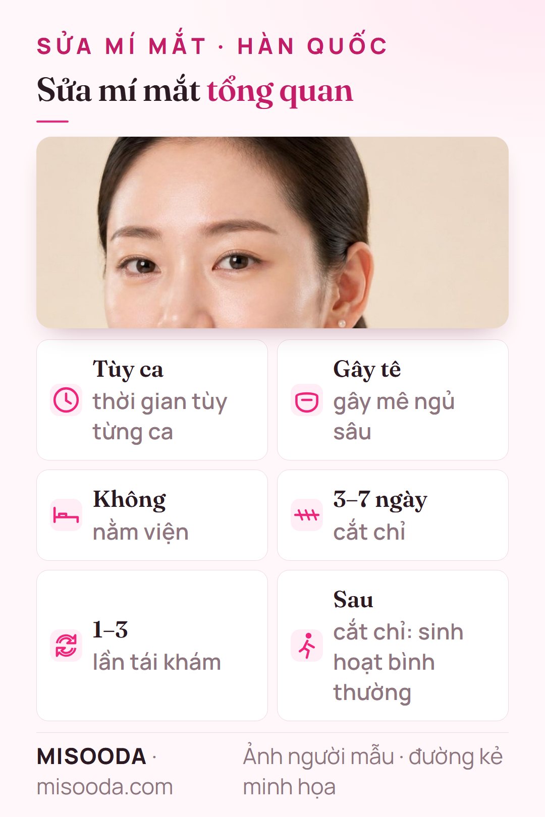 Thông tin sửa mí đôi Hàn Quốc: thời gian mổ tùy ca, gây tê ngủ sâu, không nằm viện, cắt chỉ sau 3–7 ngày, 1–3 lần tái khám