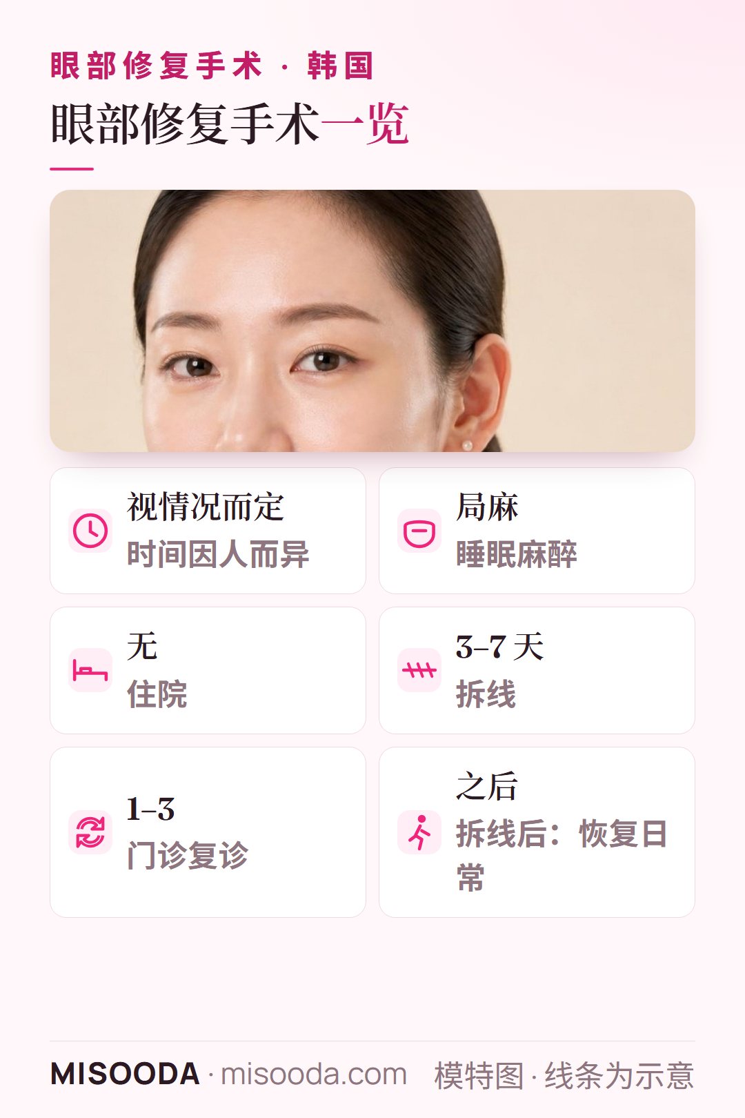 韩国 双眼皮修复手术要点:手术时间因人而异,局部睡眠麻醉,无需住院,3–7 天拆线,门诊 1–3 次