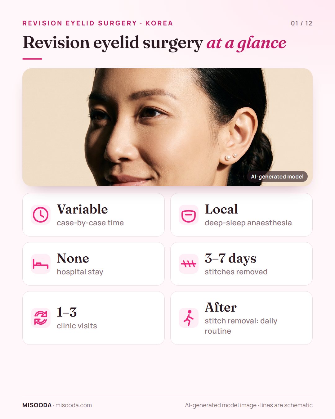 Revision double eyelid surgery facts: case-by-case operation time, local deep-sleep anaesthesia, no hospital stay, stitches out in 3–7 days, 1–3 clinic visits