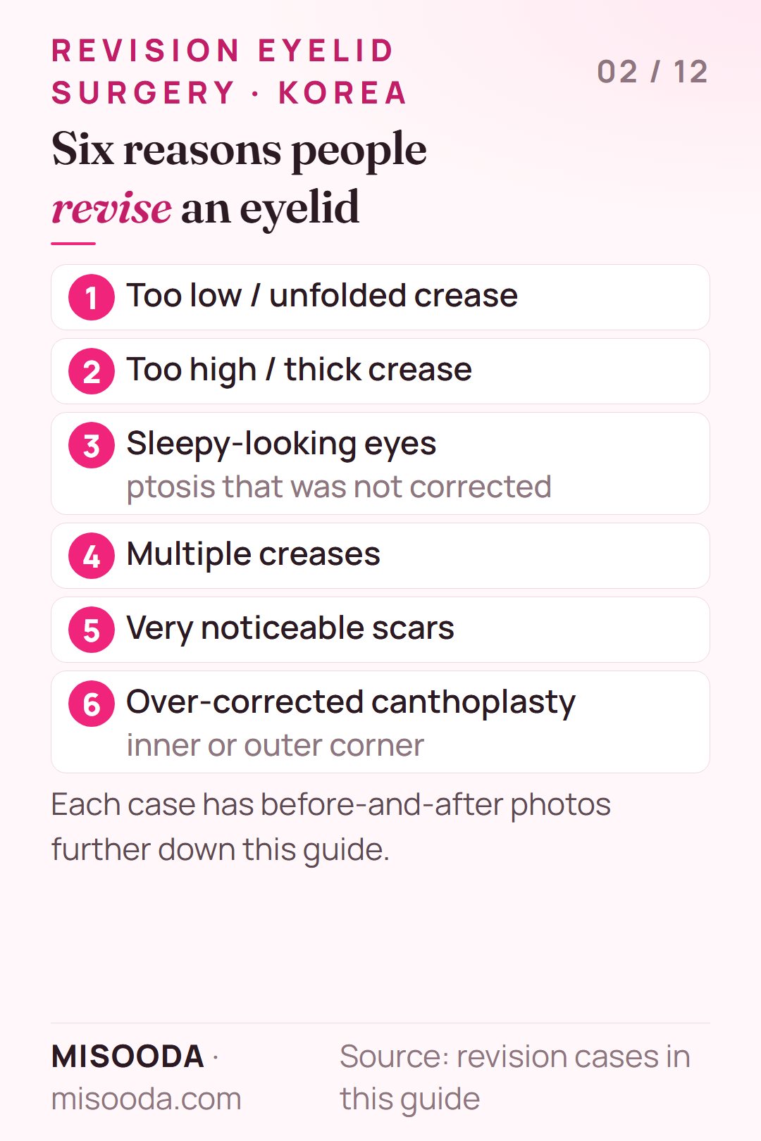 Six common revision eyelid surgery cases: too low or unfolded crease, too high or thick crease, sleepy eyes from ptosis, multiple creases, scars, over-corrected canthoplasty