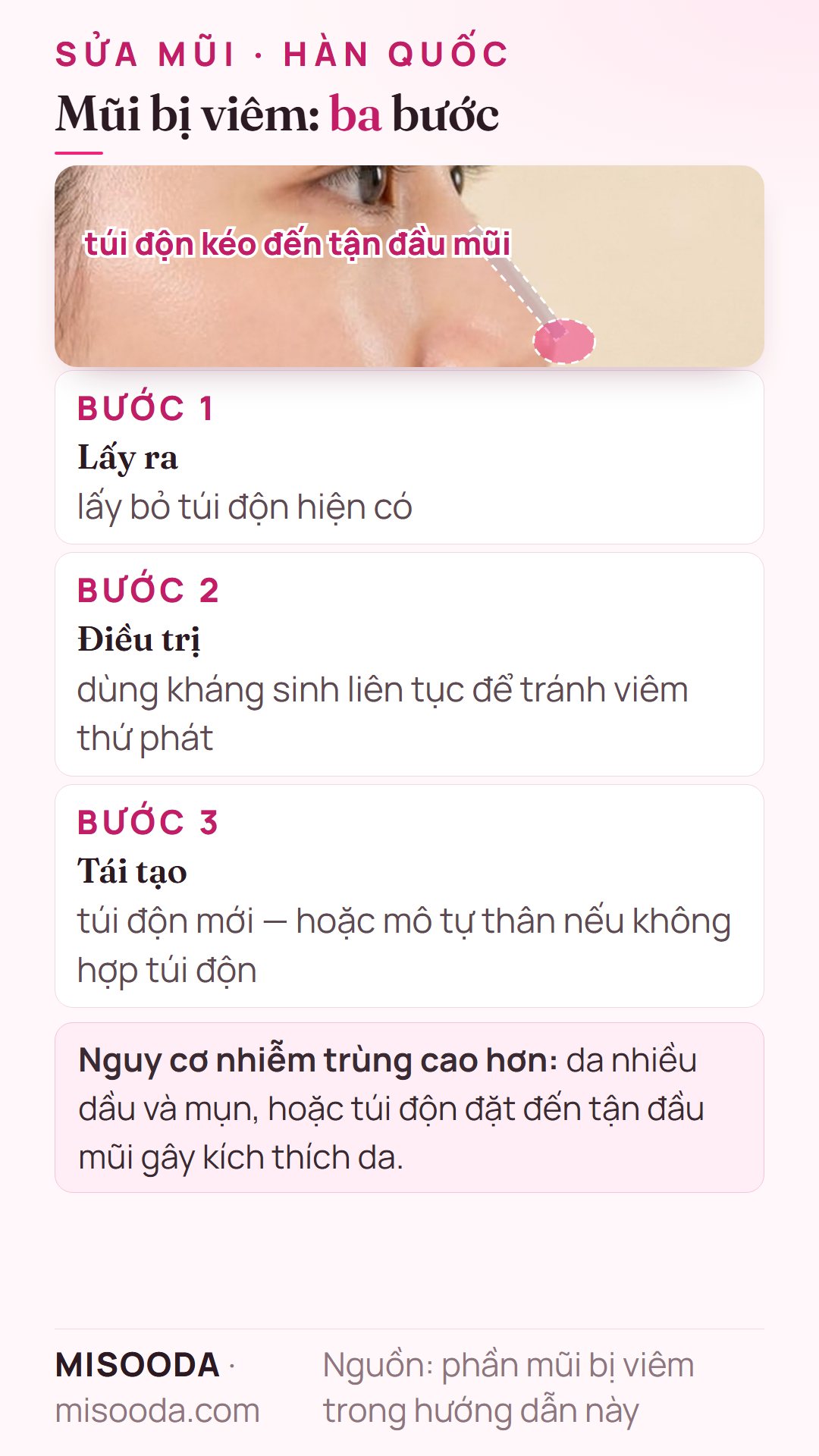 Sửa mũi bị viêm qua ba bước: lấy túi độn ra, điều trị kháng sinh liên tục, rồi tái tạo bằng túi độn mới hoặc mô tự thân