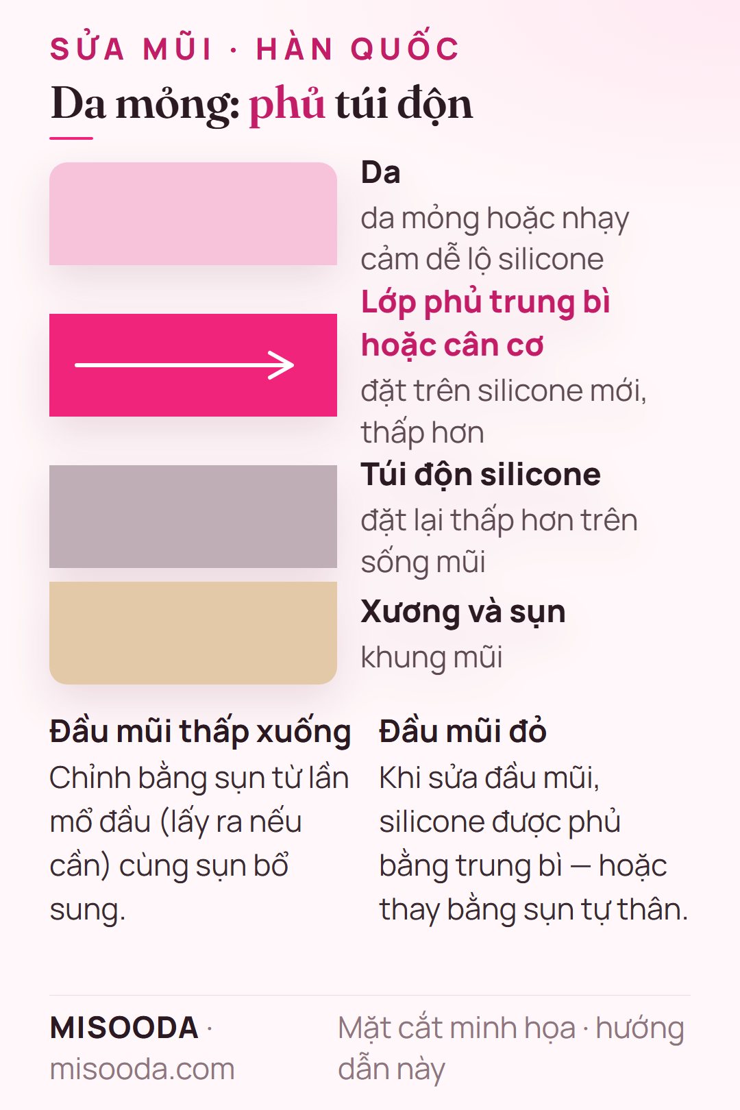 Sửa mũi lộ silicone, đầu mũi đỏ hoặc thấp: phủ trung bì hoặc cân cơ lên túi độn silicone đặt thấp hơn dưới da mỏng, nhạy cảm
