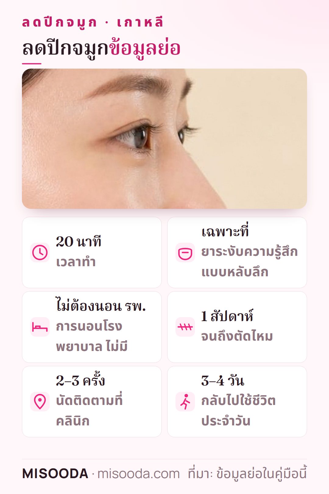 ข้อมูลย่อลดปีกจมูก เกาหลี: ราว 20 นาทีภายใต้ยาระงับความรู้สึกแบบหลับลึก ไม่ต้องนอน รพ. ตัดไหมหลัง 1 สัปดาห์ นัดคลินิก 2–3 ครั้ง ใช้ชีวิตปกติหลัง 3–4 วัน