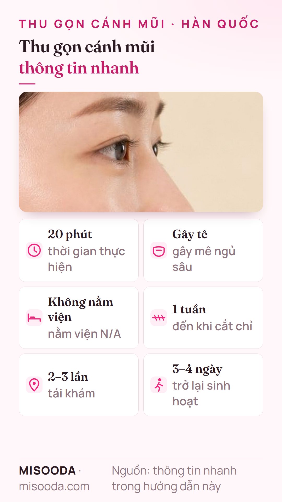 Thông tin nhanh thu gọn cánh mũi Hàn Quốc: khoảng 20 phút dưới gây tê ngủ sâu, không nằm viện, cắt chỉ sau 1 tuần, 2–3 lần tái khám, sinh hoạt lại sau 3–4 ngày