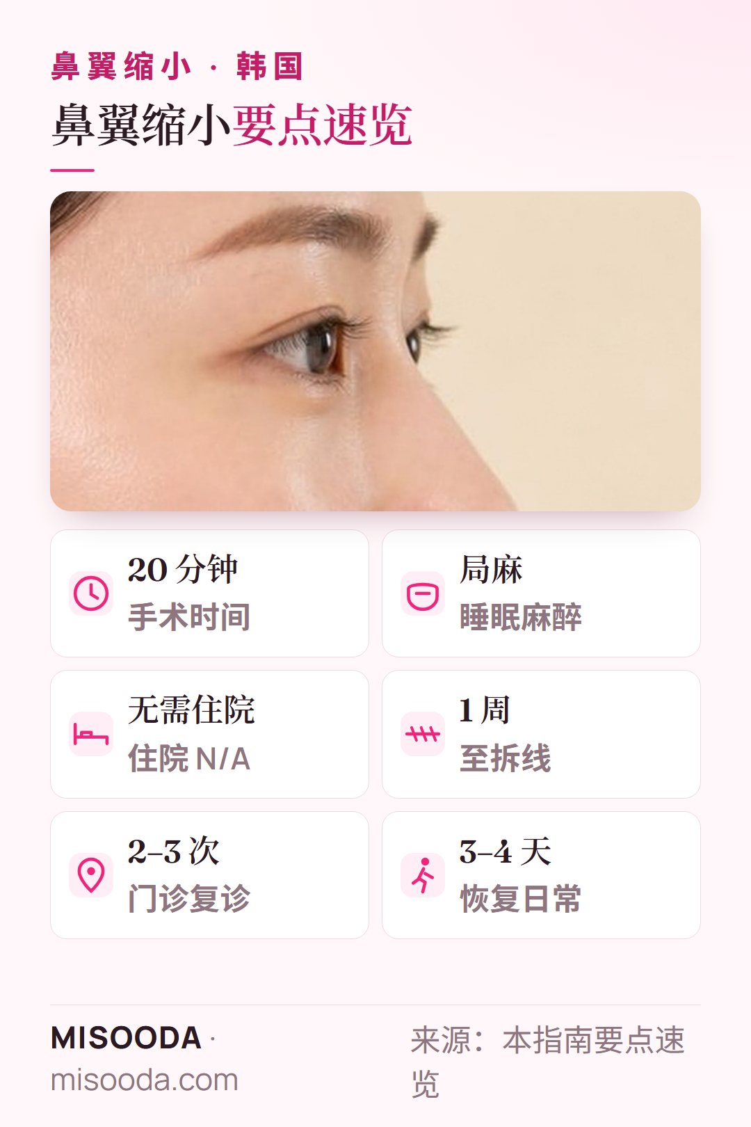 韩国 鼻翼缩小要点:局部睡眠麻醉下约 20 分钟,无需住院,1 周后拆线,门诊 2–3 次,3–4 天后恢复日常