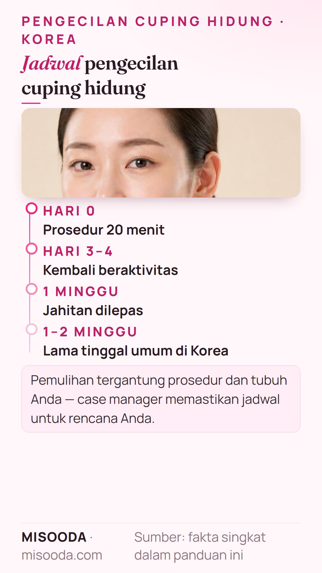 Jadwal pemulihan pengecilan cuping hidung: prosedur 20 menit, kembali beraktivitas setelah 3–4 hari, lepas jahitan setelah 1 minggu, tinggal 1–2 minggu di Korea