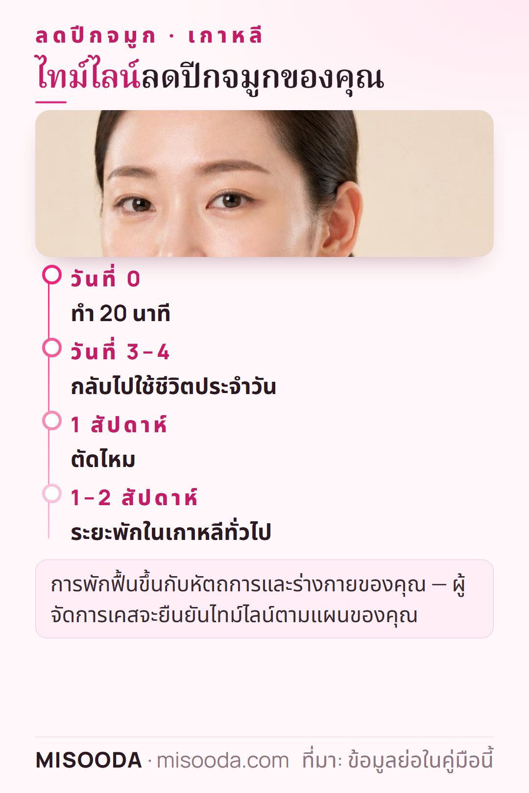 ไทม์ไลน์พักฟื้นลดปีกจมูก เกาหลี: ทำ 20 นาที กลับไปใช้ชีวิตประจำวันหลัง 3–4 วัน ตัดไหมหลัง 1 สัปดาห์ พักในเกาหลี 1–2 สัปดาห์