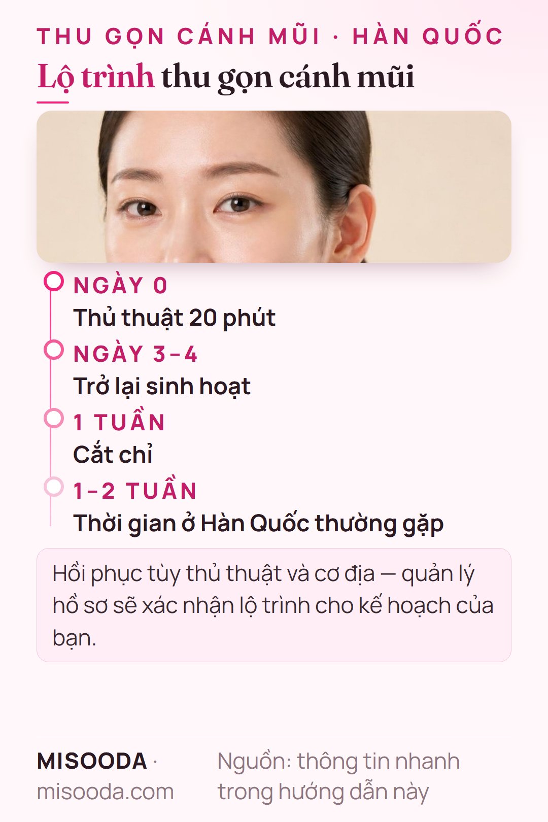 Lộ trình hồi phục thu gọn cánh mũi: thủ thuật 20 phút, sinh hoạt lại sau 3–4 ngày, cắt chỉ sau 1 tuần, ở Hàn Quốc 1–2 tuần