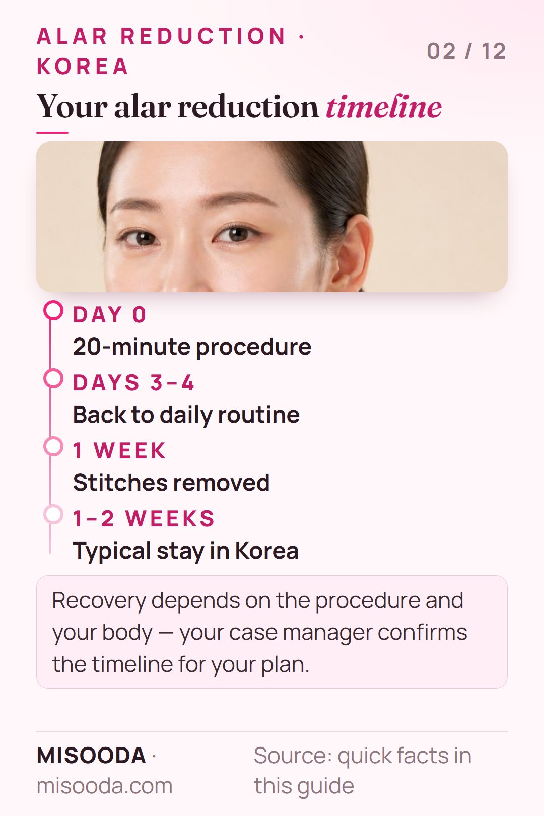 Alar reduction recovery timeline: 20-minute procedure, back to daily routine after 3–4 days, stitch removal after 1 week, 1–2 week stay in Korea