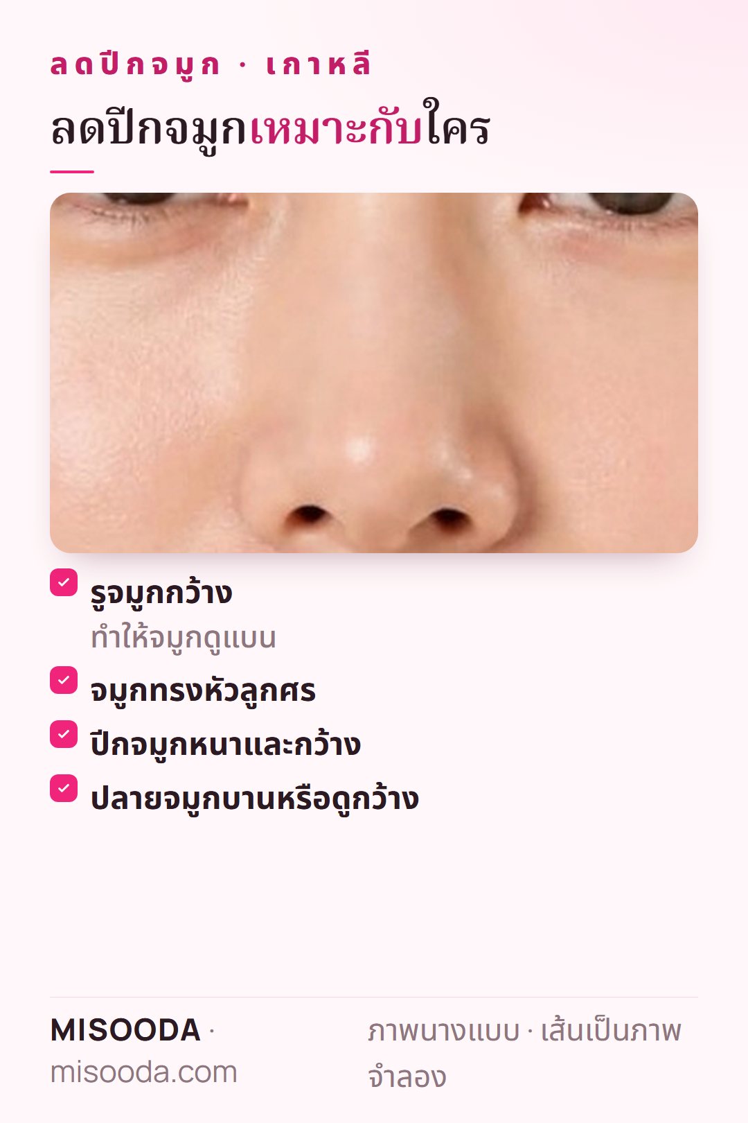 ผู้ที่เหมาะกับลดปีกจมูก เกาหลี: รูจมูกกว้างทำให้จมูกดูแบน จมูกทรงหัวลูกศร ปีกจมูกหนาและกว้าง หรือปลายจมูกบานดูกว้าง