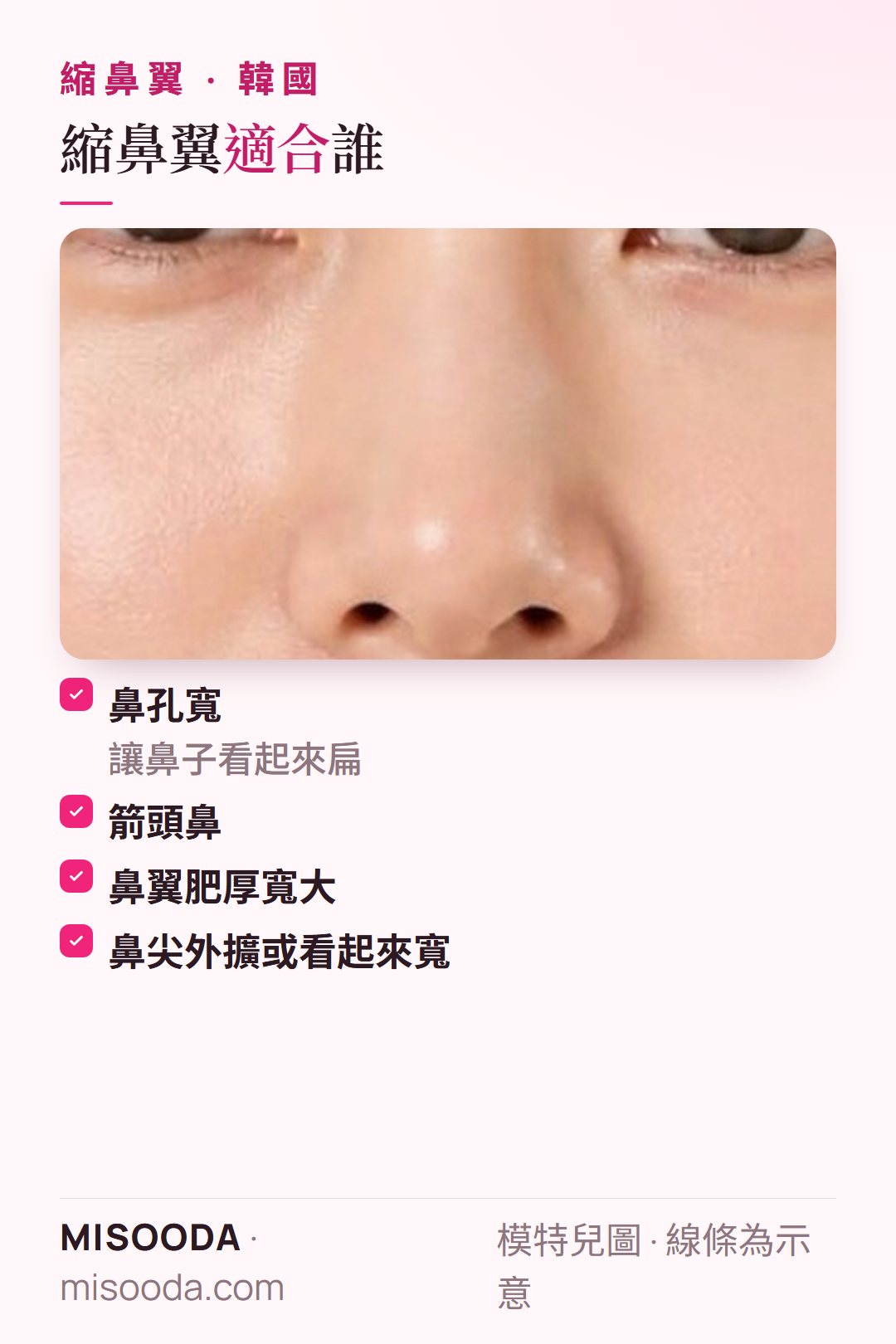 韓國 縮鼻翼適合對象:鼻孔寬讓鼻子看起來扁、箭頭鼻、鼻翼肥厚寬大,或鼻尖外擴看起來寬