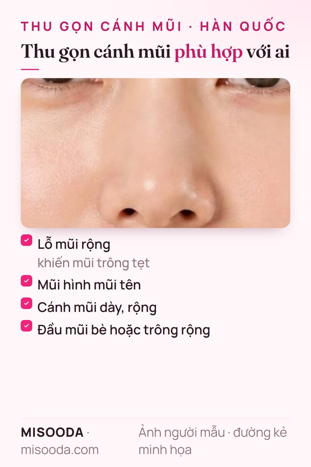 Ai phù hợp thu gọn cánh mũi: lỗ mũi rộng làm mũi trông tẹt, mũi hình mũi tên, cánh mũi dày và rộng, hoặc đầu mũi bè, trông rộng