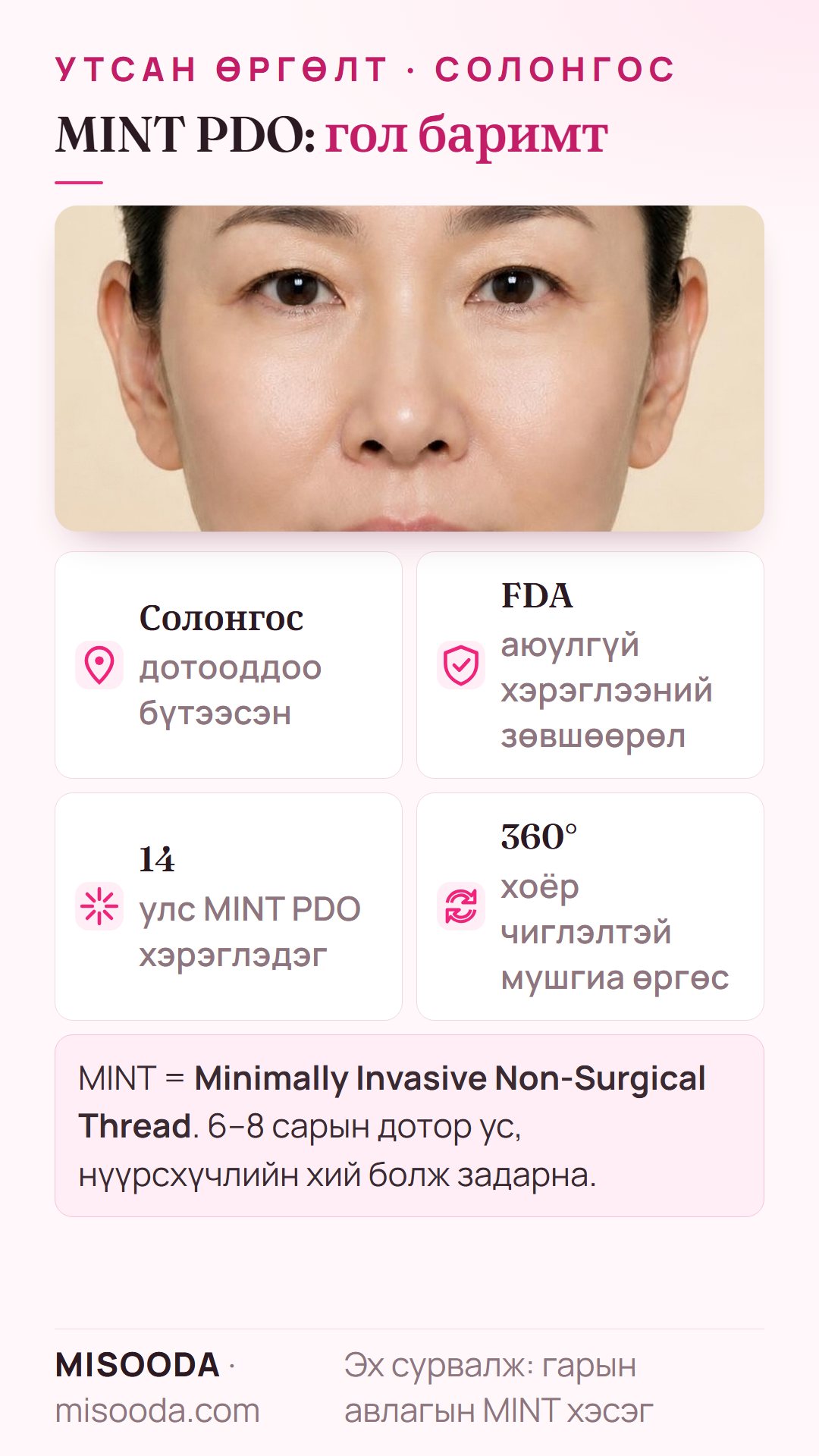 MINT PDO утсан өргөлтийн гол баримтууд: Солонгост бүтээсэн, FDA-ийн зөвшөөрөлтэй, 14 оронд хэрэглэгддэг, 360° хоёр чиглэлтэй дэгээтэй, 6–8 сард уусдаг
