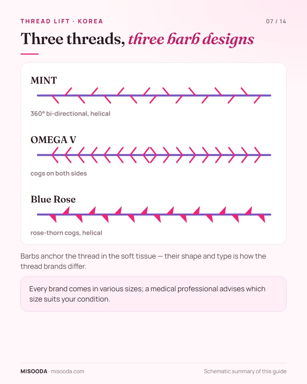 PDO thread barbs compared: MINT 360° bi-directional helical barbs, OMEGA V cogs on both sides, Blue Rose helical rose-thorn cogs