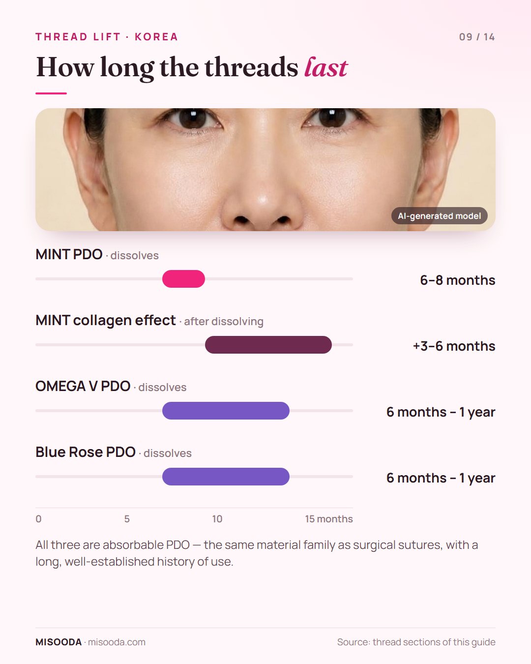 PDO thread lift dissolving time: MINT 6–8 months plus 3–6 months of collagen effect, OMEGA V and Blue Rose 6 months to 1 year