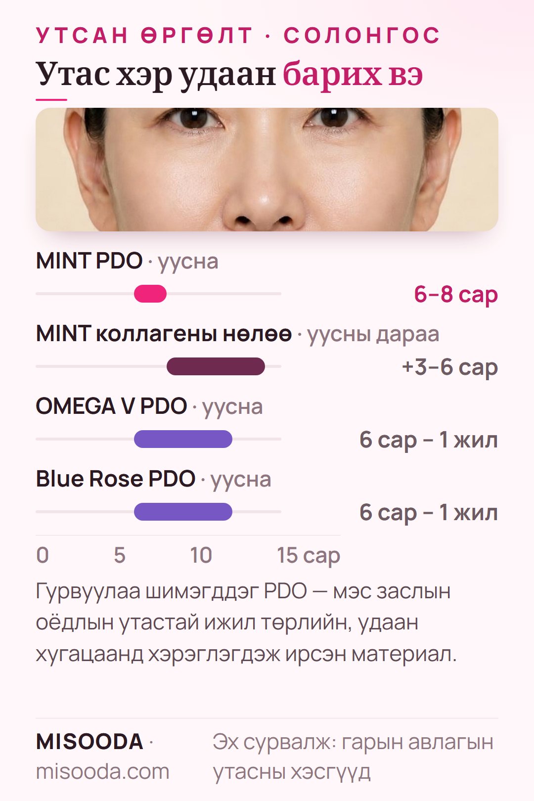PDO утасны уусах хугацаа: MINT 6–8 сар, үүн дээр коллагены нөлөө 3–6 сар, OMEGA V ба Blue Rose 6 сараас 1 жил