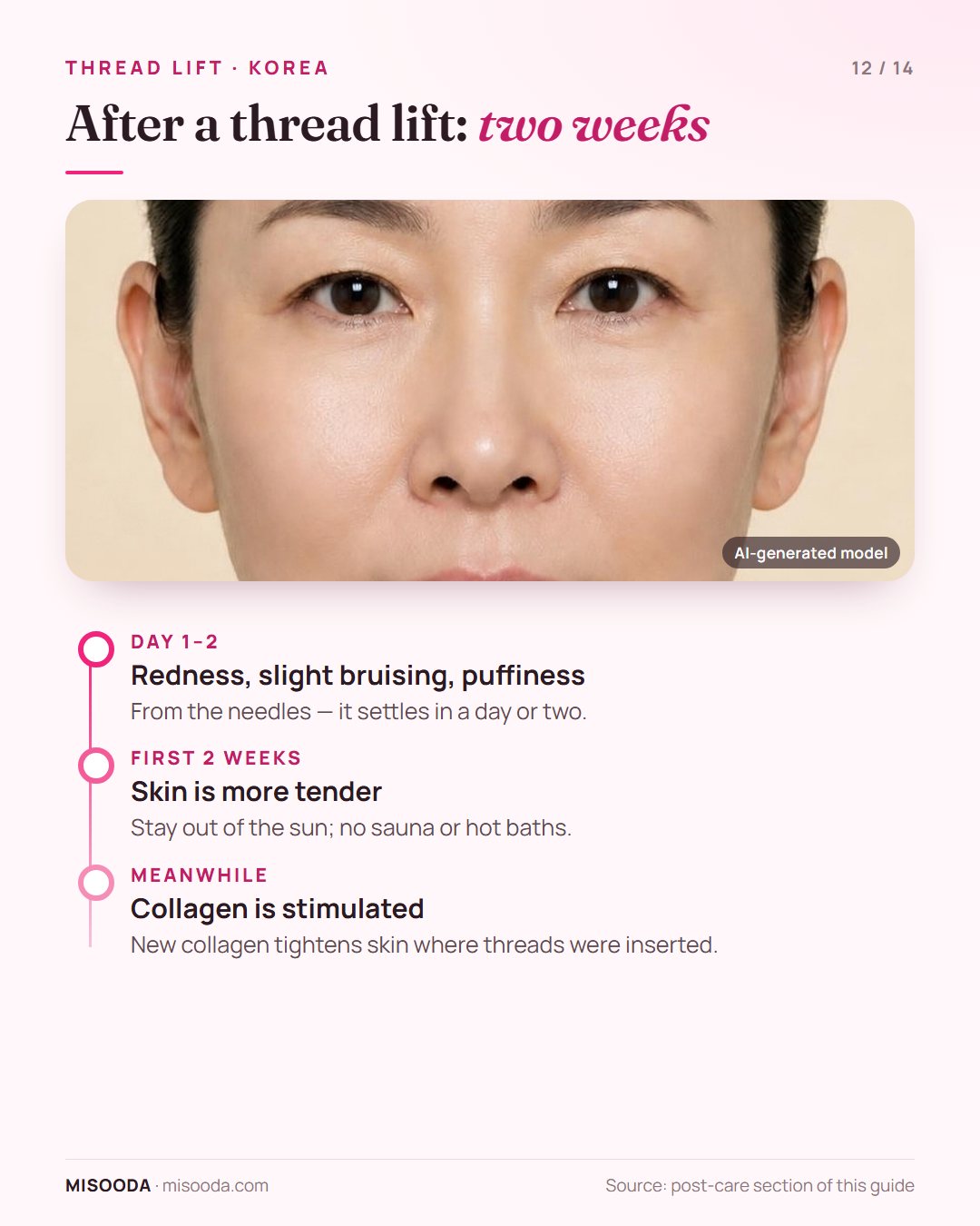 Thread lift aftercare: redness, slight bruising and puffiness for a day or two, then no sun, sauna or hot baths for 2 weeks