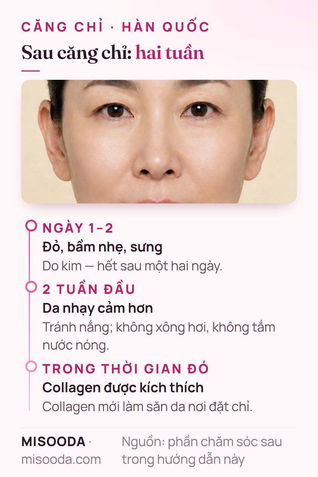 Chăm sóc sau căng chỉ: đỏ, bầm nhẹ và sưng trong một hai ngày, sau đó tránh nắng, xông hơi và tắm nóng trong 2 tuần