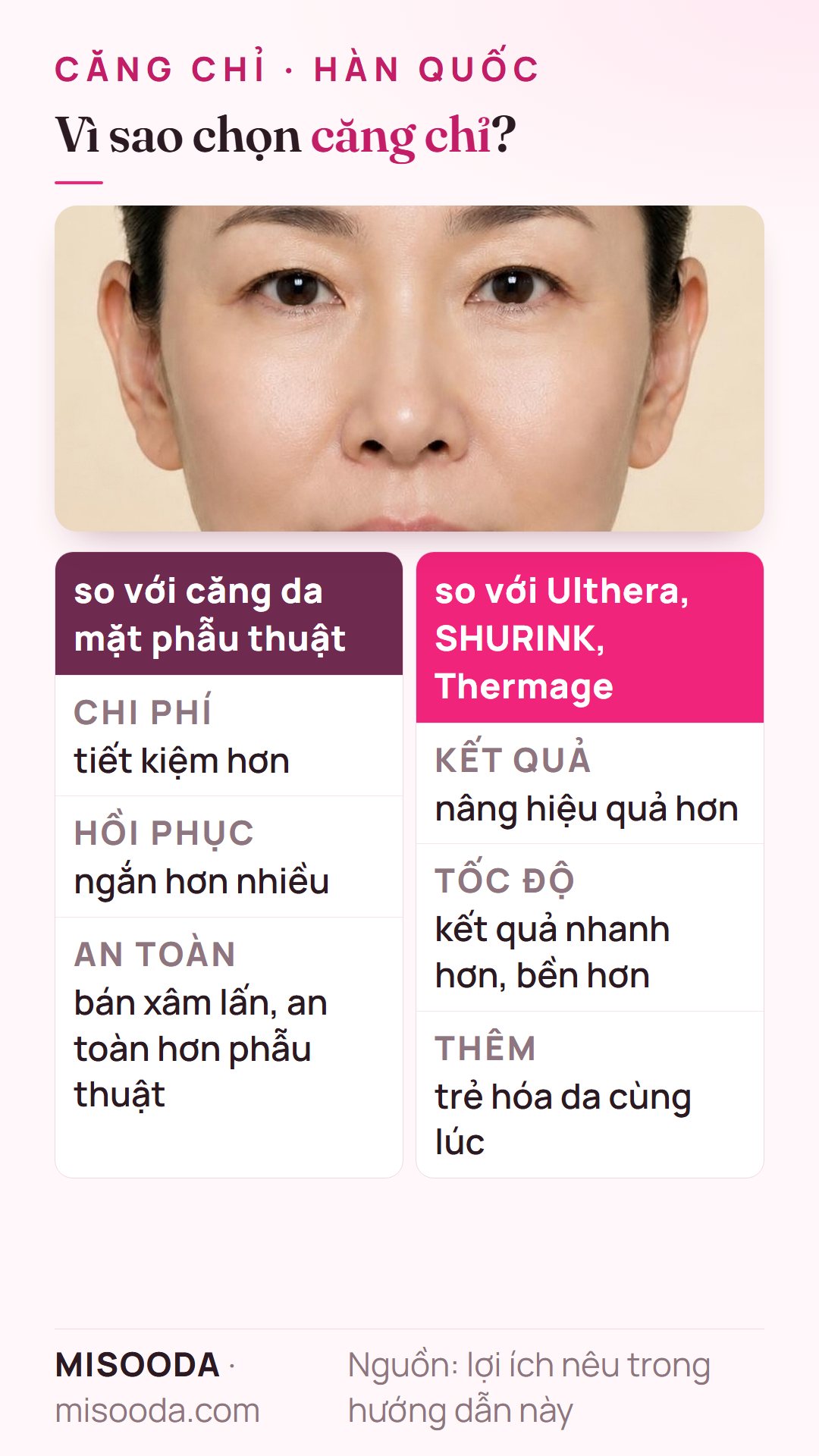 Lợi ích căng chỉ: tiết kiệm hơn, hồi phục ngắn hơn nhiều so với căng da mặt phẫu thuật, nâng mạnh hơn Ulthera, SHURINK hay Thermage