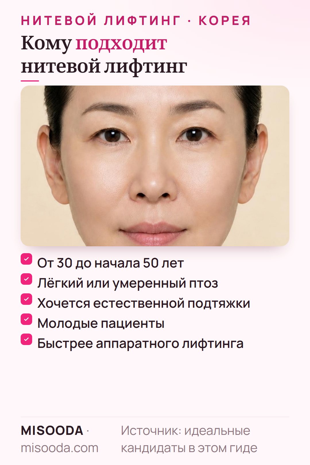 Идеальный кандидат на нитевой лифтинг: обычно от 30 до начала 50 лет, лёгкий или умеренный птоз, желание естественной подтяжки без операции