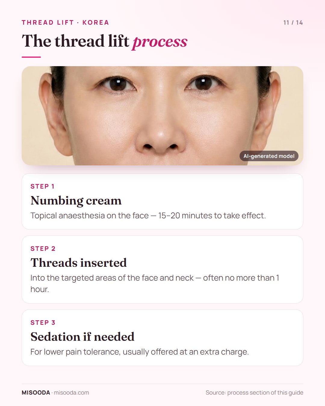 Thread lift process in Korea: numbing cream for 15–20 minutes, threads inserted in the face and neck in no more than 1 hour, optional sedation