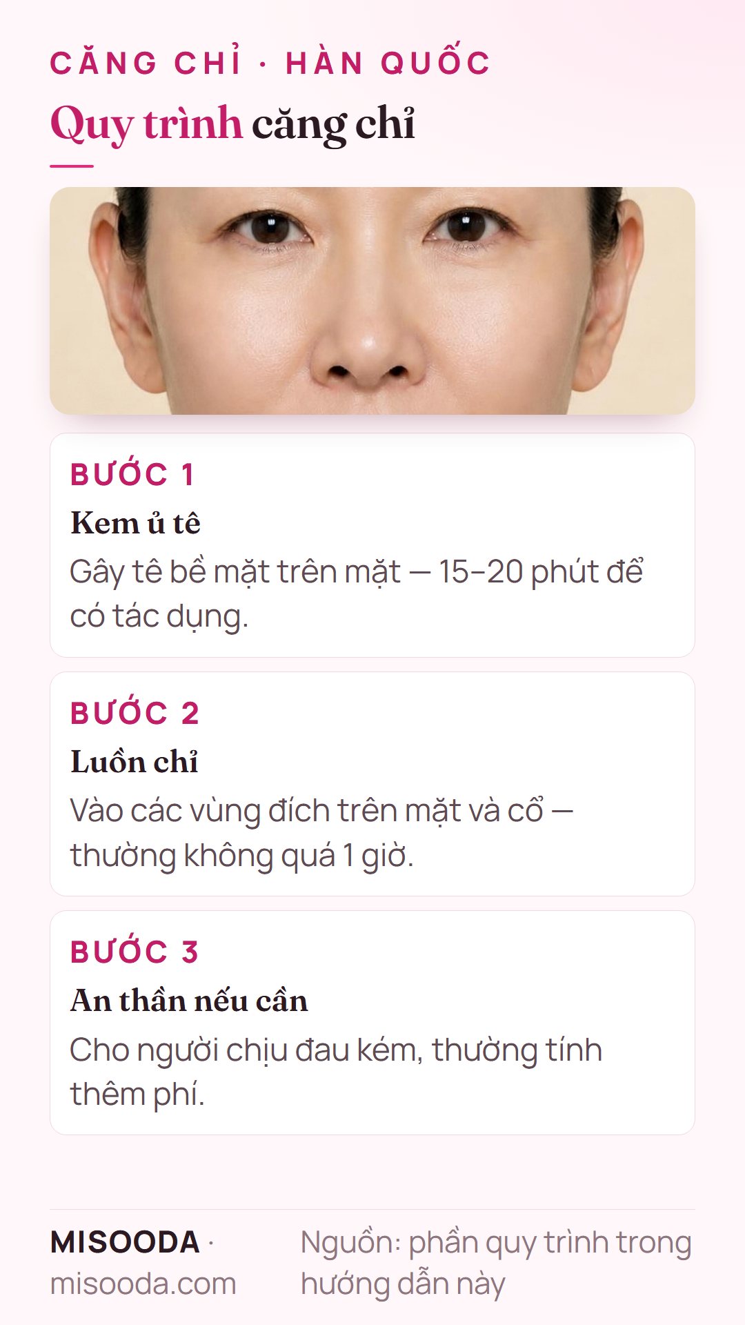 Quy trình căng chỉ tại Hàn Quốc: ủ kem tê 15–20 phút, luồn chỉ vào mặt và cổ trong không quá 1 giờ, an thần tùy chọn