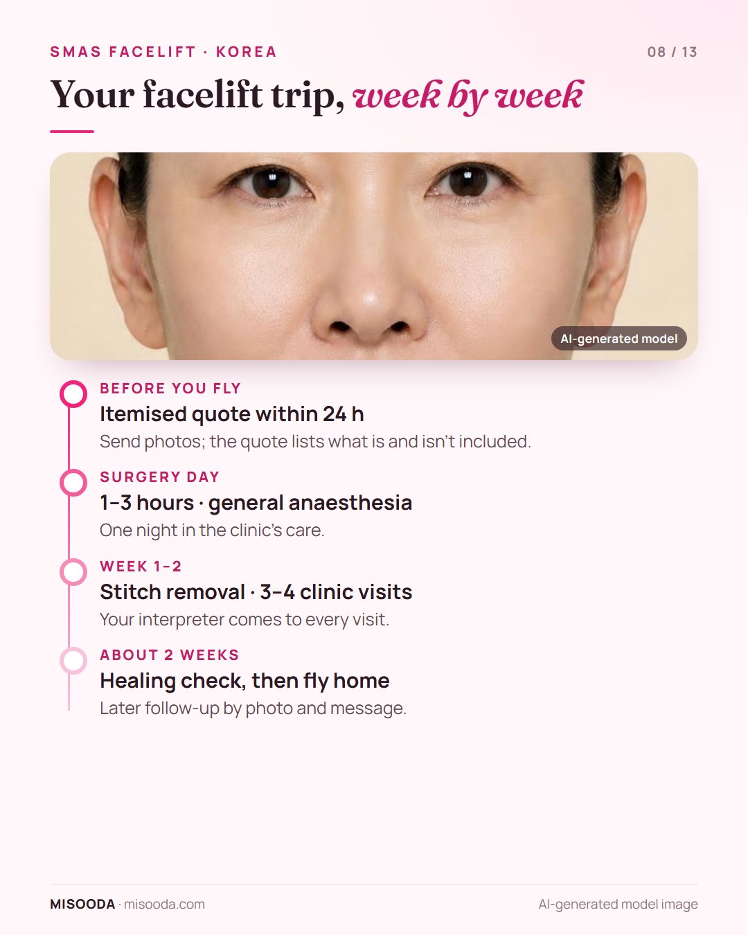 Facelift trip to Korea week by week: quote within 24 hours, surgery day, stitch removal in week 1–2, fly home after about 2 weeks