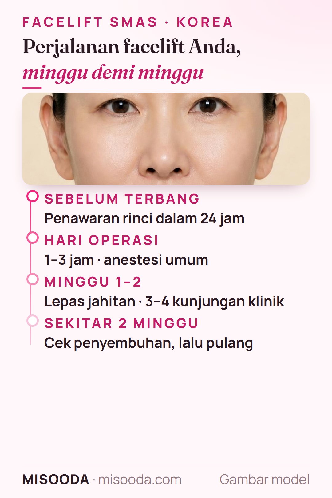 Perjalanan facelift ke Korea minggu demi minggu: penawaran dalam 24 jam, hari operasi, lepas jahitan di minggu 1–2, pulang setelah sekitar 2 minggu