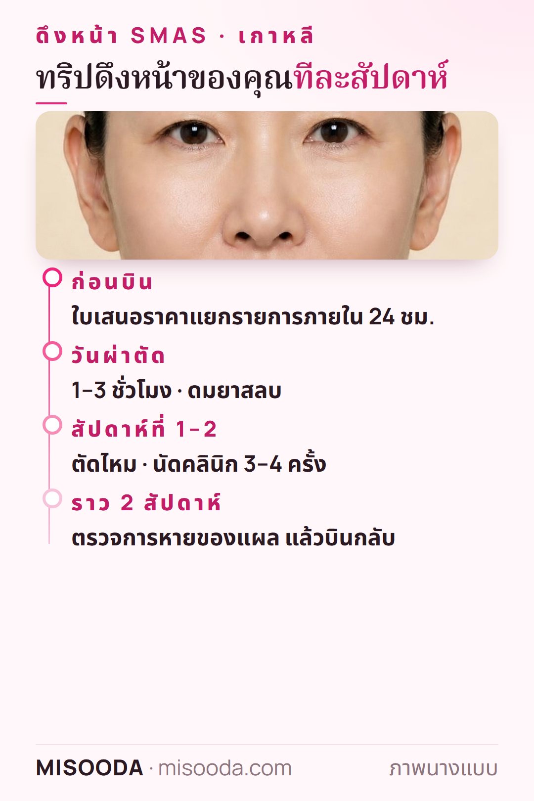 ทริปดึงหน้า เกาหลี ทีละสัปดาห์: ใบเสนอราคาภายใน 24 ชั่วโมง วันผ่าตัด ตัดไหมในสัปดาห์ที่ 1–2 บินกลับหลังราว 2 สัปดาห์