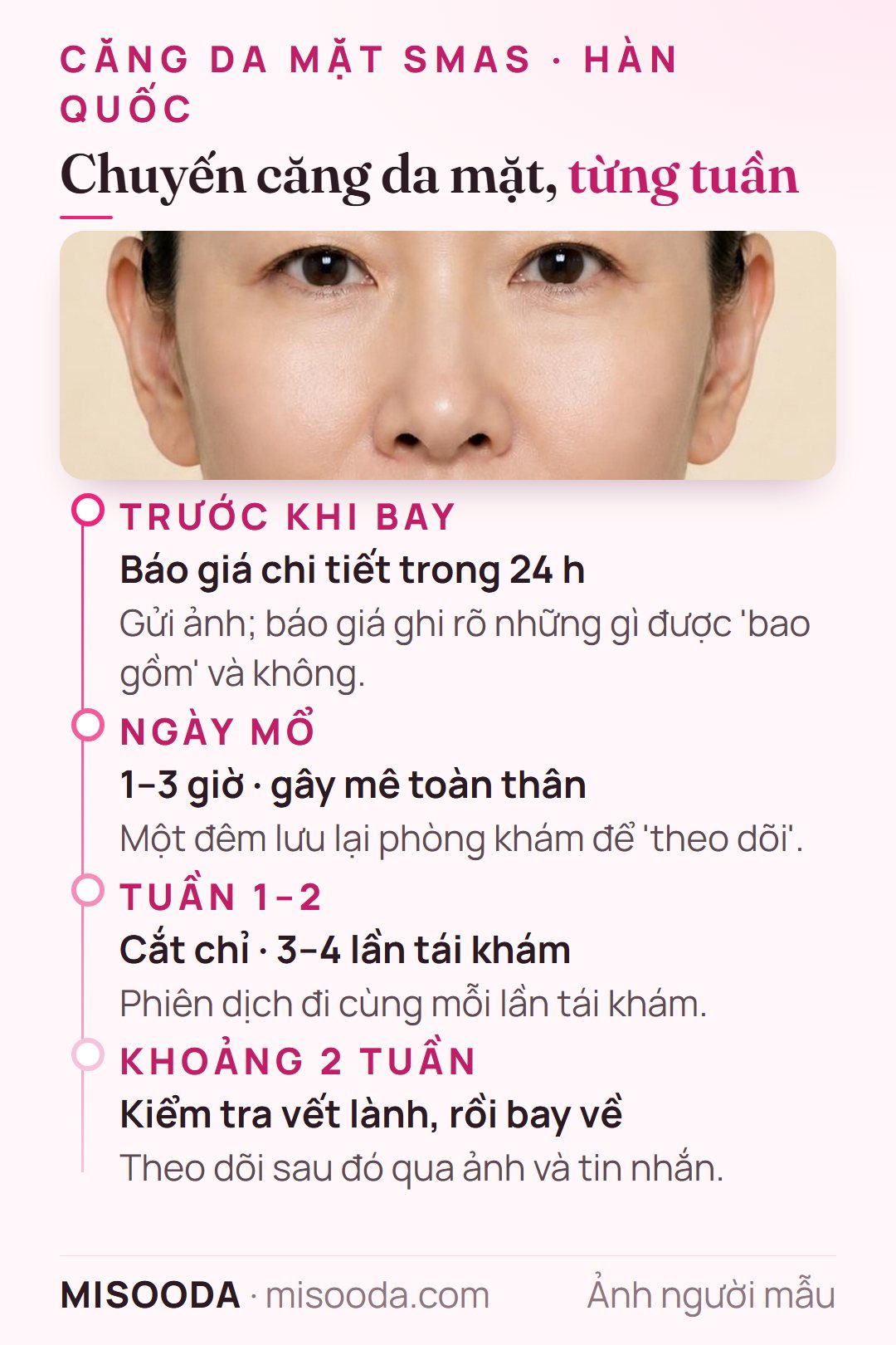 Chuyến căng da mặt tại Hàn Quốc từng tuần: báo giá trong 24 giờ, ngày mổ, cắt chỉ tuần 1–2, bay về sau khoảng 2 tuần
