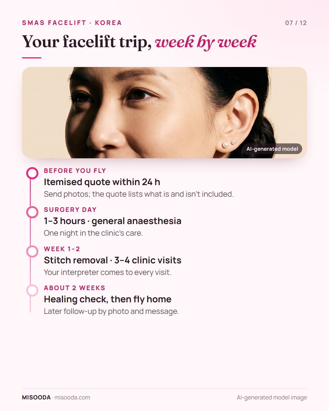Facelift trip to Korea week by week: quote within 24 hours, surgery day, stitch removal in week 1–2, fly home after about 2 weeks