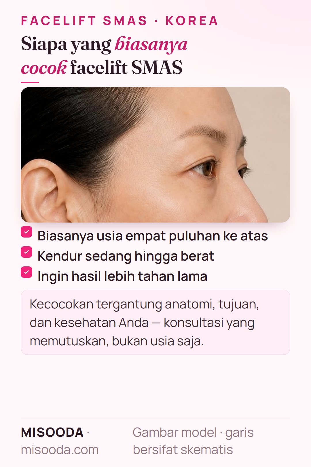 Siapa yang cocok facelift SMAS di Korea: biasanya usia 40-an ke atas, kendur sedang hingga berat, ingin hasil yang lebih tahan lama