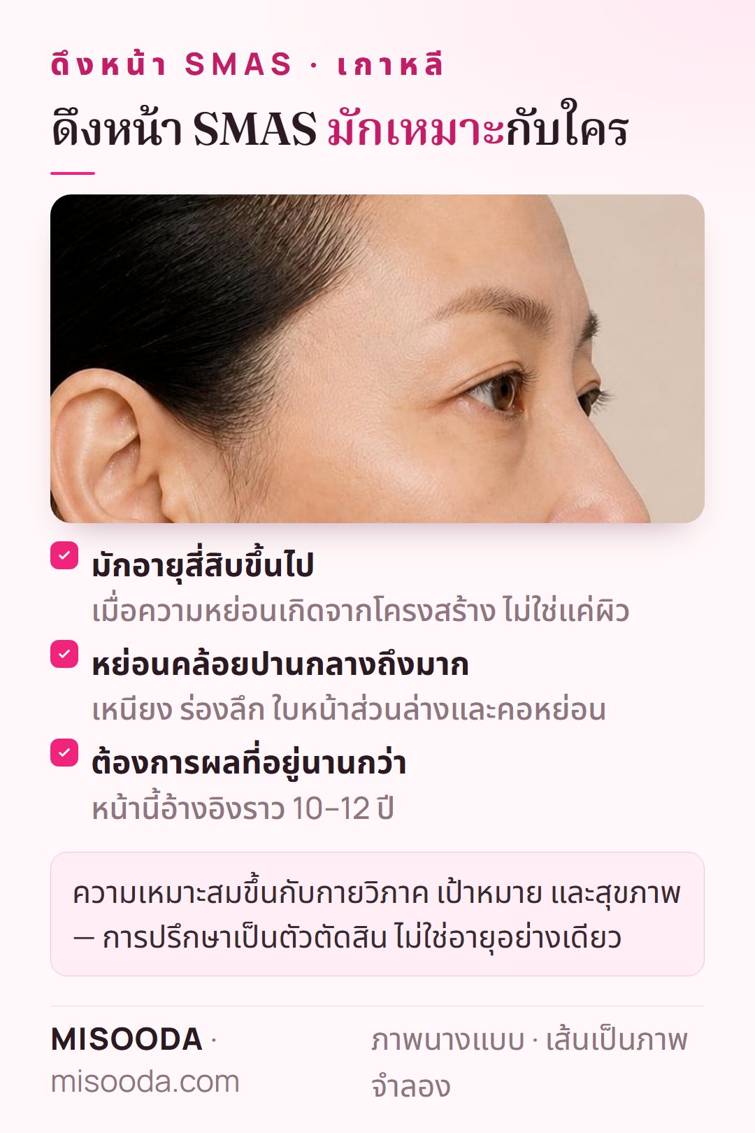 ผู้ที่เหมาะกับดึงหน้า SMAS เกาหลี: มักอายุ 40 ขึ้นไป หย่อนคล้อยปานกลางถึงมาก ต้องการผลที่อยู่นานกว่า