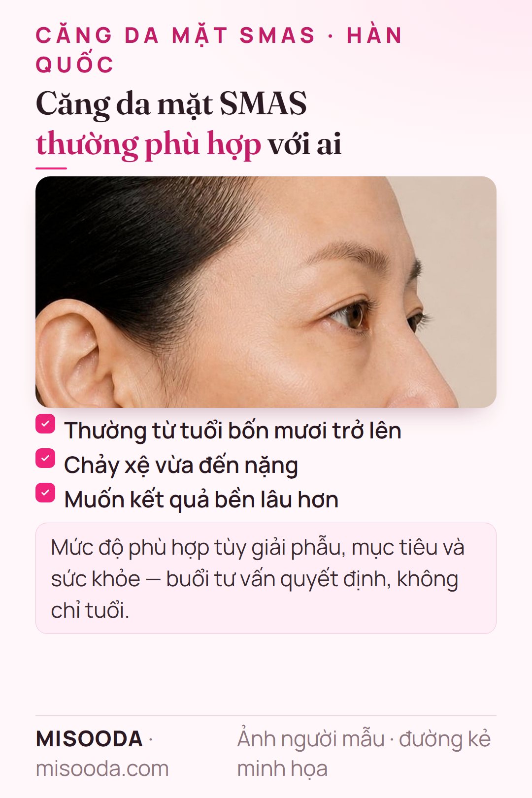 Ai phù hợp căng da mặt SMAS: thường từ tuổi 40 trở lên, chảy xệ vừa đến nặng, muốn kết quả bền lâu hơn