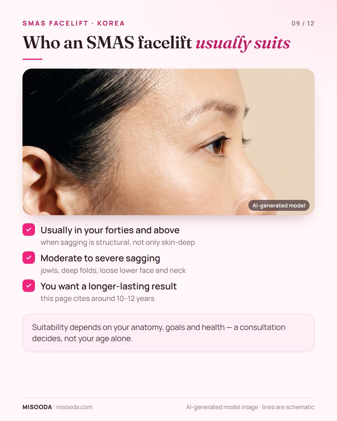 Who suits an SMAS facelift: usually 40s and above, moderate to severe sagging, wanting a longer-lasting result