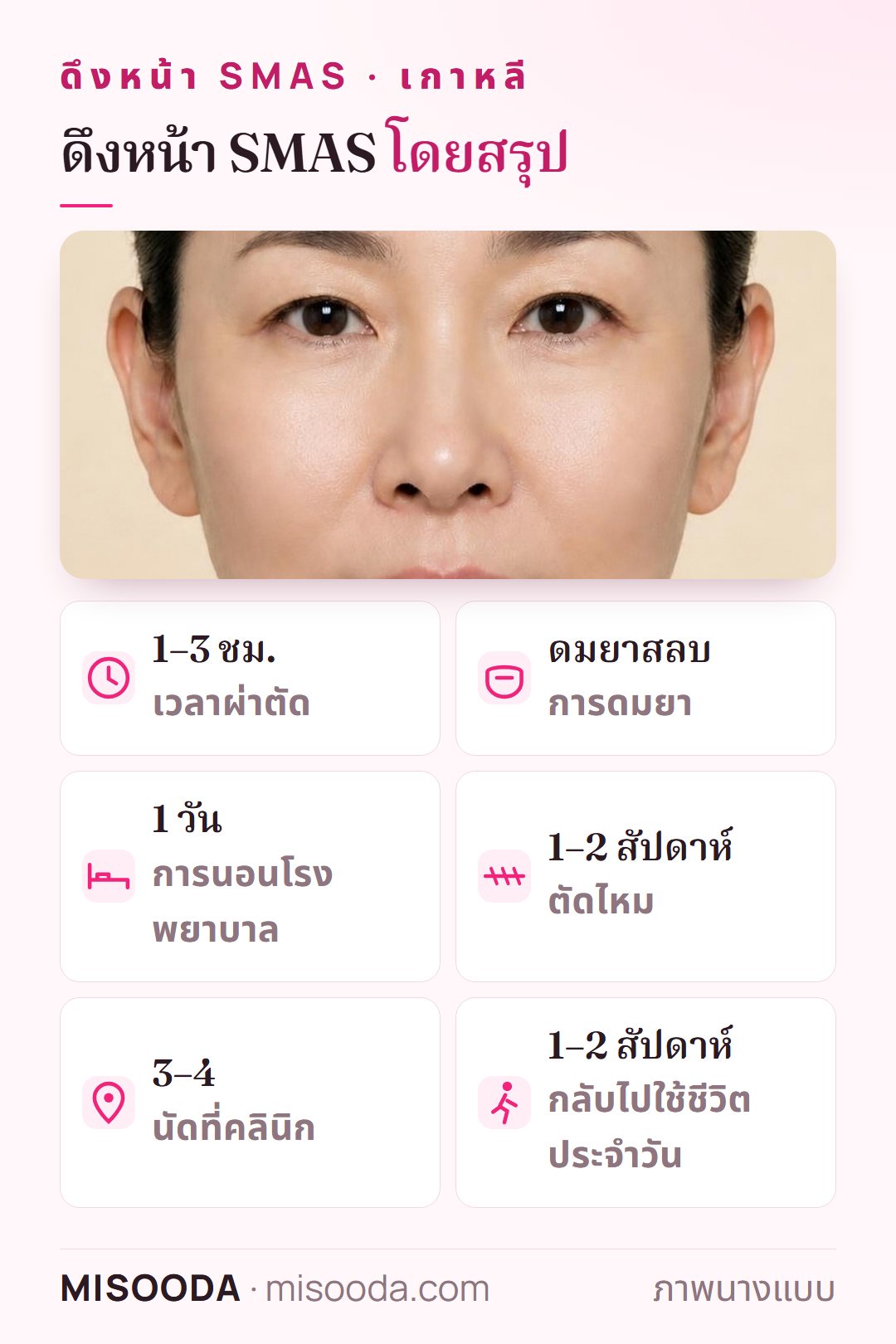 ข้อมูลย่อดึงหน้า SMAS เกาหลี: 1–3 ชั่วโมง ดมยาสลบ นอน รพ. 1 วัน ตัดไหมที่ 1–2 สัปดาห์ นัดคลินิก 3–4 ครั้ง